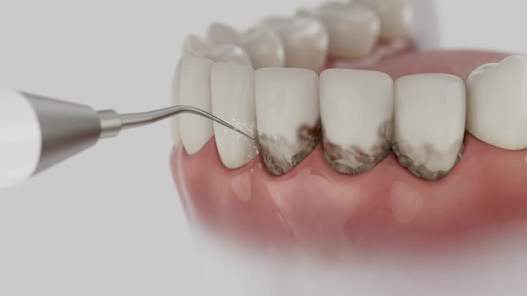 Trusted Wisdom Tooth Removal service in West St. Paul, MN - Dentist Open Now